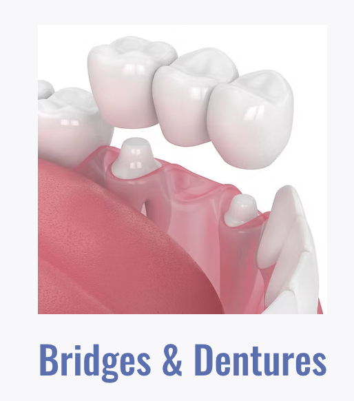 Bridges & Dentures
