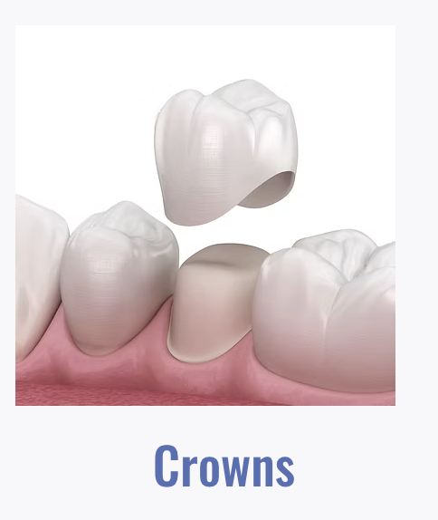 Crowns