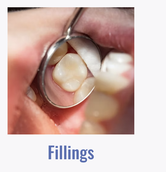 Fillings