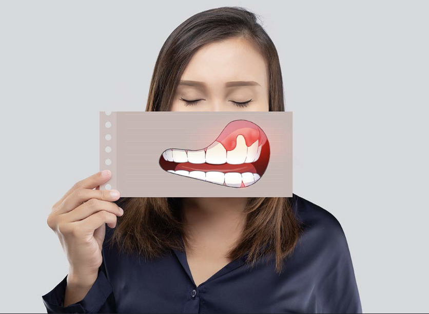 Tobacco Cessation & Oral Screening